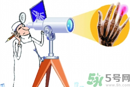 什么年齡測骨齡最好？如何測骨齡？