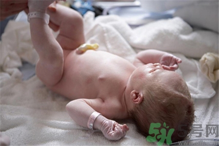 新生兒肚臍怎么護(hù)理？新生兒肚臍什么時(shí)候掉？