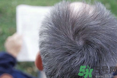 缺什么頭發(fā)會(huì)變白？年輕人頭發(fā)變白是缺維生素嗎？