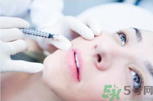 玻尿酸有副作用嗎?玻尿酸的功效與作用 玻尿酸有副作用嗎?玻尿酸的功效與作用