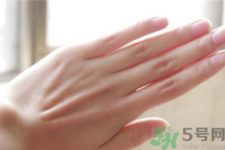 患凍瘡是身體缺什么嗎？長(zhǎng)凍瘡是身體缺維生素嗎？