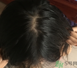 康王洗發(fā)水怎么樣?康王洗發(fā)水好用嗎? 康王洗發(fā)水怎么樣?康王洗發(fā)水好用嗎?