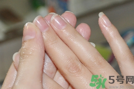 ?指甲上有豎紋是缺什么？指甲上有豎紋是缺維生素嗎？