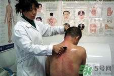 背部刮痧多久做一次比較好？刮痧經(jīng)常做會有依賴性嗎？