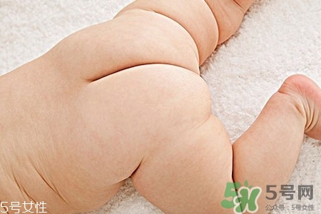 擴(kuò)肛有什么好處？擴(kuò)肛需要注意什么？