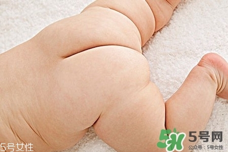 擴肛疼嗎？擴肛手術(shù)會很疼嗎？