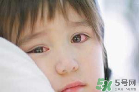 孩子為什么老眨眼睛？孩子總眨眼睛怎么回事？