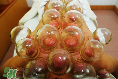 拔罐后皮膚癢能撓嗎？拔罐后身上癢切忌抓撓