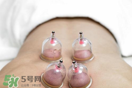 冬天拔罐后多久能洗澡？警惕冬季拔罐后不宜立即洗澡