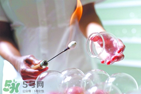 拔罐后可以泡澡嗎？拔罐后多久能泡澡？