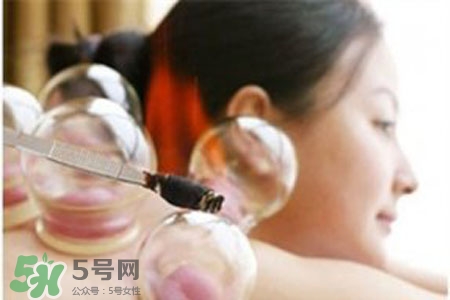 冬天拔火罐能減肥嗎？拔火罐什么季節(jié)減肥效果最好？