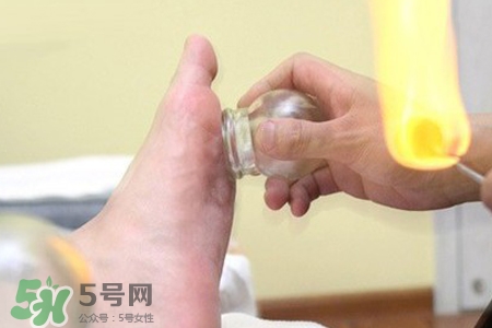 冬天拔火罐能減肥嗎？拔火罐什么季節(jié)減肥效果最好？