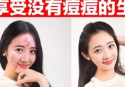 伊詩蘭頓祛痘怎么樣？伊詩蘭頓祛痘膏有用嗎？