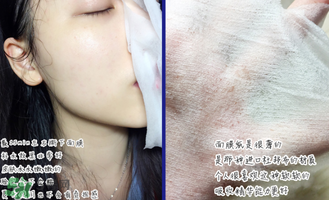 稚優(yōu)泉面膜怎么用？稚優(yōu)泉面膜要洗嗎？