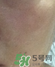 skin1004是什么牌子？skin1004屬于什么檔次