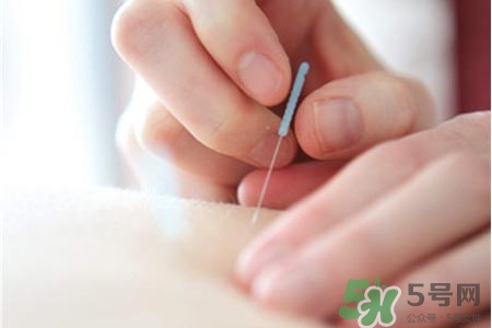 腰間盤突出可以針灸嗎？針灸能治腰間盤突出嗎？