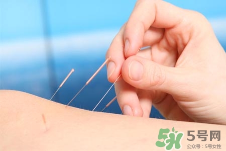 腰間盤突出可以針灸嗎？針灸能治腰間盤突出嗎？