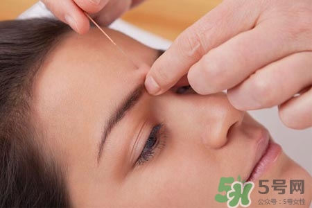 腰間盤突出可以針灸嗎？針灸能治腰間盤突出嗎？