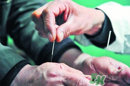 腰間盤突出可以針灸嗎？針灸能治腰間盤突出嗎？