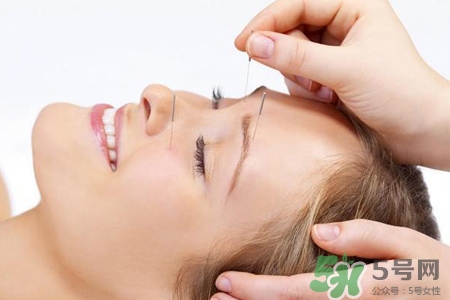 腰間盤突出可以針灸嗎？針灸能治腰間盤突出嗎？