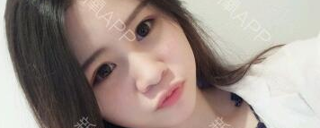 定點(diǎn)雙眼皮能保持多久？定點(diǎn)雙眼皮是永久的嗎？