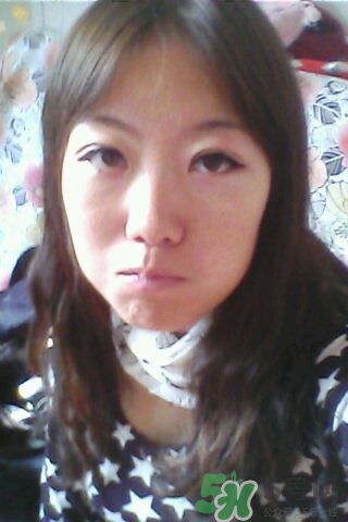 什么是定點(diǎn)雙眼皮？定點(diǎn)雙眼皮多少錢(qián)？
