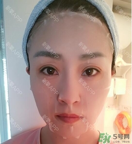 埋線雙眼皮能保持多久？埋線雙眼皮是永久嗎