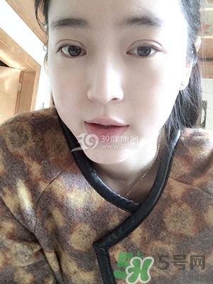 什么是定點(diǎn)雙眼皮？定點(diǎn)雙眼皮多少錢(qián)？