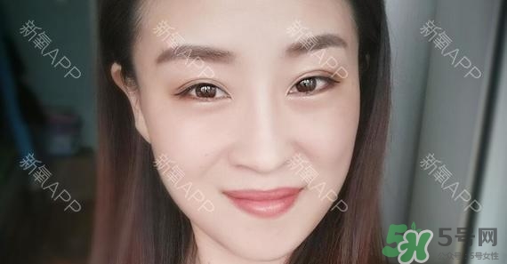 埋線雙眼皮能保持多久？埋線雙眼皮是永久嗎