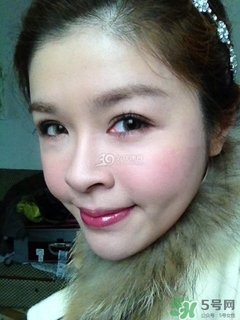 重瞼術(shù)是什么？重瞼術(shù)是永久的嗎？