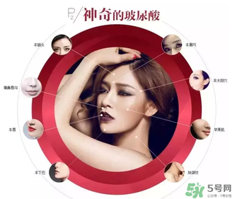 喬雅登是哪個國家的？喬雅登玻尿酸哪個國家？