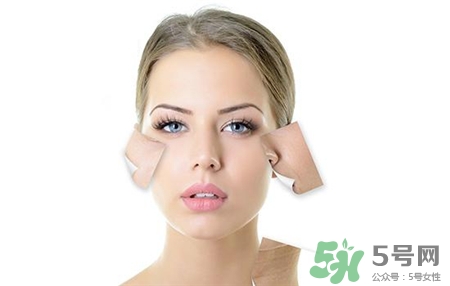 果酸換膚可以去黑頭嗎?果酸換膚能去黑頭嗎? 果酸換膚可以去黑頭嗎?果酸換膚能去黑頭嗎?