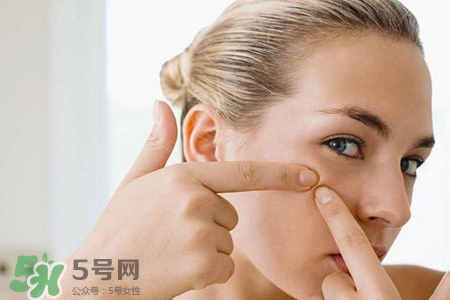 膠原蛋白能祛痘嗎？膠原蛋白可以祛痘嗎？