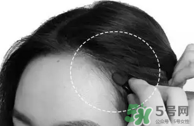 發(fā)際線高適合什么發(fā)型？發(fā)際線高怎么辦