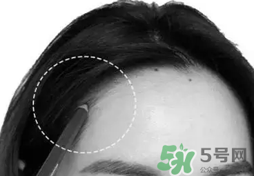 發(fā)際線高適合什么發(fā)型？發(fā)際線高怎么辦