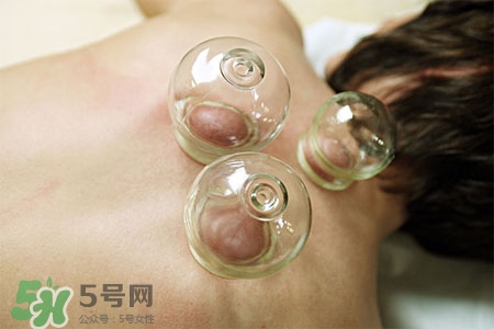 拔罐放血會(huì)得傳染病么？拔罐放血會(huì)傳染疾病嗎？