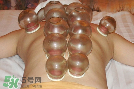 拔罐分季節(jié)嗎？不同季節(jié)的拔罐禁忌