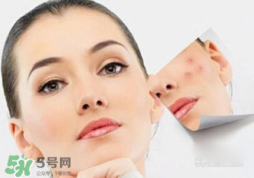 封閉性粉刺會(huì)自己消失嗎？封閉性粉刺好了會(huì)留疤嗎？