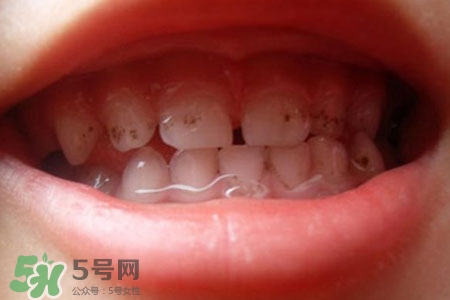 刷牙后吃東西發(fā)苦正常嗎？為什么刷牙后吃東西發(fā)苦？