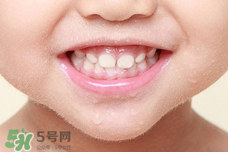 刷牙后吃東西發(fā)苦正常嗎？為什么刷牙后吃東西發(fā)苦？