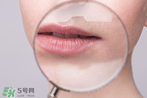 嘴唇起泡腫了怎么辦？嘴唇起泡腫了怎么消腫