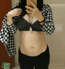 預(yù)防妊娠紋用什么好？懷孕期間如何預(yù)防妊娠紋