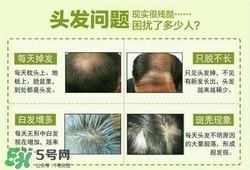 牛角梳梳頭可以生發(fā)嗎？牛角梳怎么梳頭？