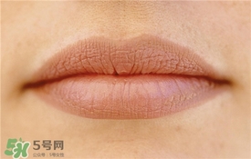 卡唇紋是什么意思？卡唇紋怎么辦？