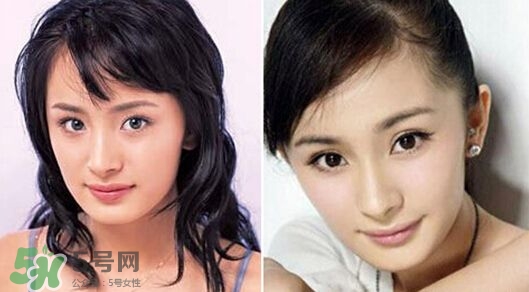 打瘦臉針能懷孕嗎？打瘦臉針能吃避孕藥嗎？