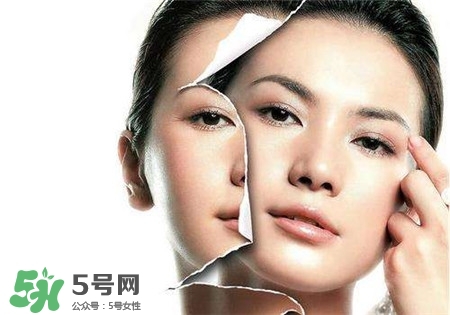 美白針是什么？美白針可以連續(xù)打嗎？