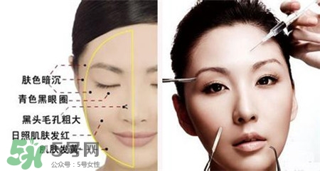 美白針的效果明顯嗎？美白針一個(gè)療程幾次？