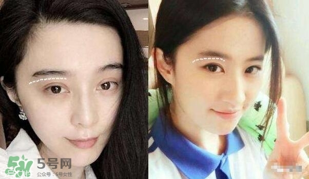 割雙眼皮有幾種做法？雙眼皮有哪幾種形狀？