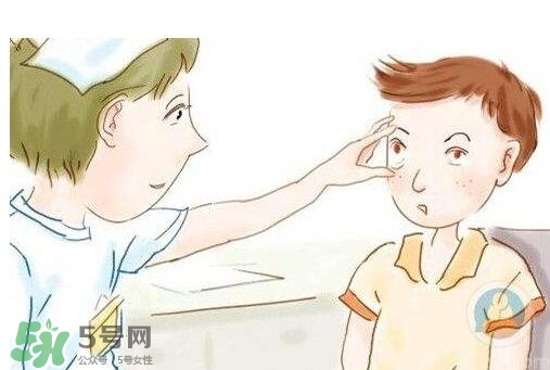 紅眼病用什么眼藥水好？紅眼病吃什么好得快