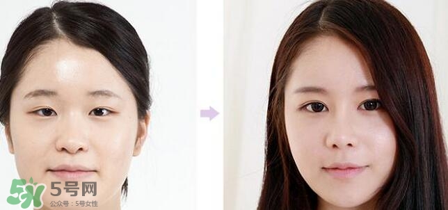 哪些人需要開眼角？需要開眼角的眼睛圖片